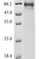 Human Complement component C8 beta chain (C8B) Recombinant Protein, N-10His/C-Myc - BioCrest Sci