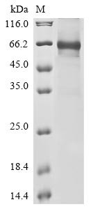 Human Complement component C8 beta chain (C8B) Recombinant Protein, N-10His/C-Myc, Homo sapiens (Human), E.coli, N-terminal 10xHis-tagged and C-terminal Myc-tagged, 68.5 kDa, purity >≥ 85% as determined by SDS-PAGE.
