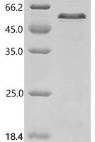 Mouse Osteopontin (Spp1), partial Recombinant Protein, C-His - BioCrest Sci