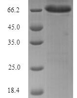 Junin mammarenavirus Nucleoprotein (N) Recombinant Protein - BioCrest Sci