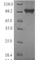 Human Sulfotransferase family cytosolic 2B member 1 (SULT2B1) Recombinant Protein - BioCrest Sci
