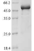 Human DNA damage-binding protein 2 (DDB2) Recombinant Protein - BioCrest Sci