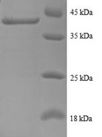 Human 40S ribosomal protein S24 (RPS24), partial Recombinant Protein - BioCrest Sci