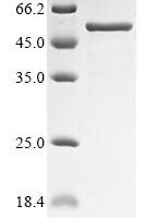 Human Pregnancy-specific beta-1-glycoprotein 1 (PSG1) Recombinant Protein - BioCrest Sci