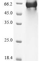 Human Complement component C8 beta chain (C8B) Recombinant Protein, N-His - BioCrest Sci