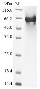 Human Complement component C8 beta chain (C8B) Recombinant Protein, N-His, Homo sapiens (Human), E.coli, N-terminal 6xHis-tagged, 67.0 kDa, purity >≥ 85% as determined by SDS-PAGE.