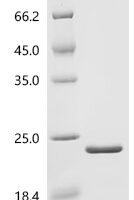 Phleum pratense Profilin-1 (PRO1) Recombinant Protein, C-His, aa 2–131, E.coli - BioCrest Sci