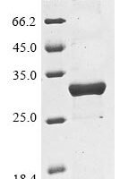 Klebsiella pneumoniae Beta-lactamase SHV-3 (bla) Recombinant Protein - BioCrest Sci