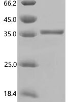 Human Insulin-like growth factor 2 (IGF2), partial Recombinant Protein - BioCrest Sci