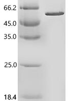 Human RecQ-like DNA helicase BLM (BLM), partial Recombinant Protein, C-His - BioCrest Sci