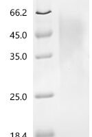 Rat Parathyroid hormone/parathyroid hormone-related peptide receptor (Pth1r), partial Recombinant Protein - BioCrest Sci