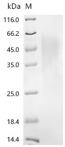 Rat Parathyroid hormone/parathyroid hormone-related peptide receptor (Pth1r), partial Recombinant Protein, Rattus norvegicus (Rat), Yeast, C-terminal 6xHis-tagged, 20.1 kDa, purity >≥ 95% as determined by SDS-PAGE.