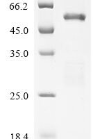 Mouse Histone acetyltransferase p300 (Ep300), partial Recombinant Protein - BioCrest Sci