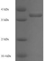 Streptomyces lividans DNA-binding protein HU 1 (hup1) Recombinant Protein - BioCrest Sci