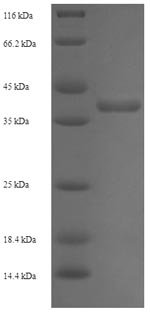 Streptomyces lividans DNA-binding protein HU 1 (hup1) Recombinant Protein, Streptomyces lividans, E.coli, N-terminal GST-tagged, 36.9 kDa, purity >≥ 90% as determined by SDS-PAGE.