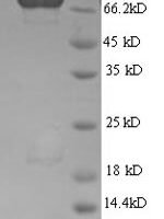 Human AP-2 complex subunit mu (AP2M1) Recombinant Protein, N-GST - BioCrest Sci