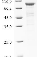 Human Band 4.1-like protein 5 (EPB41L5) Recombinant Protein, N-10His, aa 1–733, E.coli - BioCrest Sci