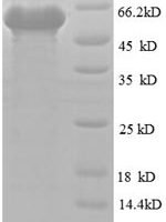 Human Obg-like ATPase 1 (OLA1) Recombinant Protein - BioCrest Sci