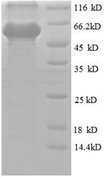 Human Obg-like ATPase 1 (OLA1) Recombinant Protein, Homo sapiens (Human), E.coli, N-terminal 6xHis-SUMO-tagged, 60.7 kDa, purity >≥ 90% as determined by SDS-PAGE.