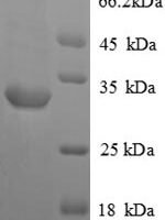 Rat Vasopressin V1a receptor (Avpr1a), partial Recombinant Protein - BioCrest Sci
