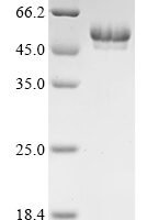 Human E3 ubiquitin-protein ligase AMFR (AMFR), partial Recombinant Protein - BioCrest Sci