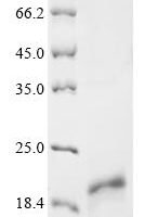 Human immunodeficiency virus type 1 Protein Tat (tat) Recombinant Protein - BioCrest Sci