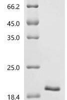 Mouse Leukocyte cell-derived chemotaxin-2（Lect2) Recombinant Protein - BioCrest Sci