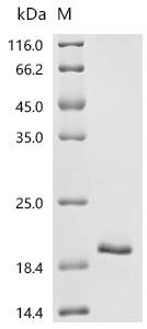 Mouse Leukocyte cell-derived chemotaxin-2(Lect2) Recombinant Protein, Mus musculus (Mouse), Mammalian cell, C-terminal 10xHis-tagged, 17.3 kDa, purity >≥ 95% as determined by SDS-PAGE.