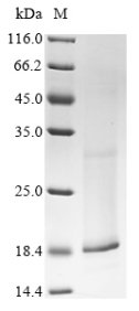 Human Potassium voltage-gated channel subfamily E member 2 (KCNE2) Recombinant Protein, Homo sapiens (Human), in vitro E.coli expression system, N-terminal 10xHis-tagged, 17.3 kDa, purity >≥ 90% as determined by SDS-PAGE.