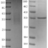 Mouse Legumain (Lgmn) Recombinant Protein - BioCrest Sci