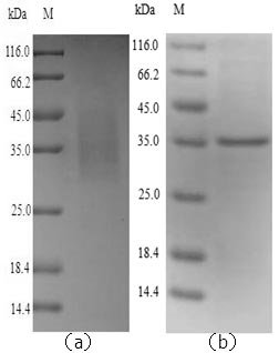 Mouse Legumain (Lgmn) Recombinant Protein, Mus musculus (Mouse), Yeast, N-terminal 6xHis-tagged, 36.8 kDa, purity >≥ 90% as determined by SDS-PAGE.