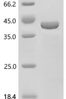Escherichia coli Trehalose-6-phosphate phosphatase (otsB) Recombinant Protein, N-His/C-His - BioCrest Sci