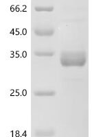 Mouse Gastric inhibitory polypeptide (Gip), partial Recombinant Protein, N-hFc, aa 44–144 - BioCrest Sci