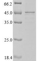 Human Actin, cytoplasmic 1 (ACTB) Recombinant Protein, N-10His/C-Myc - BioCrest Sci