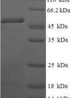 Human Anamorsin (CIAPIN1) Recombinant Protein - BioCrest Sci