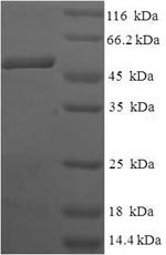 Human Anamorsin (CIAPIN1) Recombinant Protein, Homo sapiens (Human), E.coli, N-terminal 6xHis-SUMO-tagged, 49.6 kDa, purity >≥ 90% as determined by SDS-PAGE.