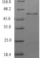 Human Beta-1,3-N-acetylglucosaminyltransferase lunatic fringe (LFNG) Recombinant Protein - BioCrest Sci