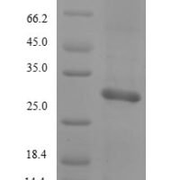 Rat Mast cell protease 2 (Mcpt2) Recombinant Protein, N-His/C-Myc, aa 21–247, E.coli - BioCrest Sci