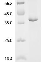 Human Meteorin-like protein (METRNL) Recombinant Protein, C-His - BioCrest Sci