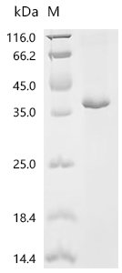 Human Meteorin-like protein (METRNL) Recombinant Protein, C-His, Homo sapiens (Human), E.coli, C-terminal 6xHis-tagged, 36.9 kDa, purity >≥ 90% as determined by SDS-PAGE.