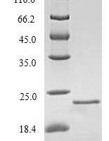 Rat Regenerating islet-derived protein 3-beta (Reg3b) Recombinant Protein, N-His - BioCrest Sci