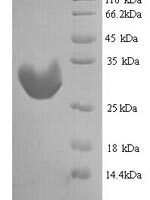Mouse Insulin-like growth factor-binding protein 1 (Igfbp1) Recombinant Protein, N-His - BioCrest Sci