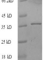 Human Proliferation marker protein Ki-67 (MKI67), partial Recombinant Protein, N-His, aa 2962–3254 - BioCrest Sci