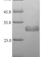 Listeria monocytogenes serovar 1/2a 1-phosphatidylinositol phosphodiesterase (plcA) Recombinant Protein - BioCrest Sci
