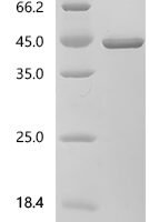 Human Aldo-keto reductase family 1 member C4 (AKR1C4) Recombinant Protein, C-His - BioCrest Sci