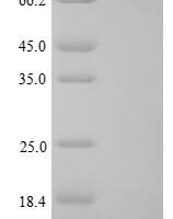 Rat Gamma-crystallin B (Crygb) Recombinant Protein - BioCrest Sci