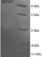 Human Proteasome subunit beta type-4 (PSMB4) Recombinant Protein - BioCrest Sci