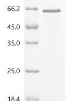 Mouse Myristoylated alanine-rich C-kinase substrate (Marcks) Recombinant Protein, N-10His - BioCrest Sci