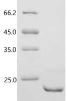 Human Prolactin-inducible protein (PIP) Recombinant Protein, C-His - BioCrest Sci