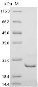 Human Prolactin-inducible protein (PIP) Recombinant Protein, C-His, Homo sapiens (Human), E.coli, C-terminal 6xHis-tagged, 20.4 kDa, purity >≥ 85% as determined by SDS-PAGE.